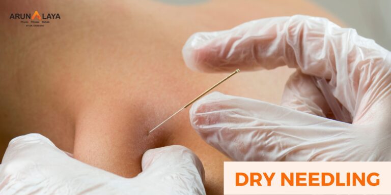 Dry Needling for Pain Relief: A Comprehensive Guide