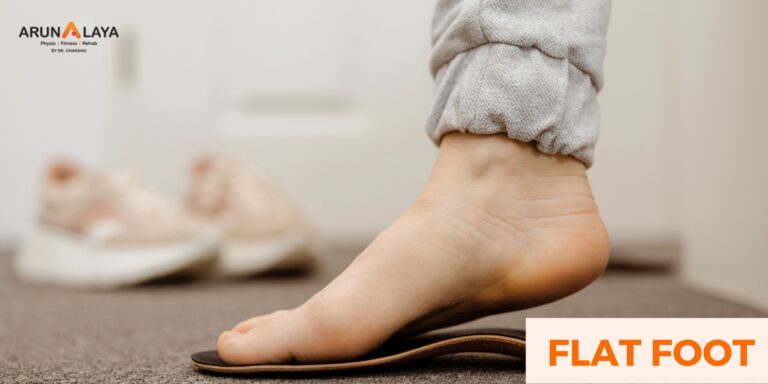 Step by Step: Physiotherapy’s Path to Alleviating Flat Feet Without Surgery