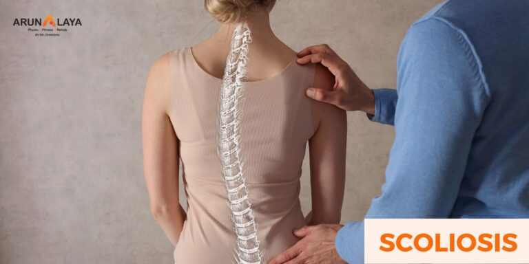 Unraveling the Role of Physiotherapy in the Journey of Scoliosis Recovery