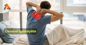 Cervical Spondylitis: Causes, Symptoms & Treatment