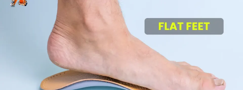 Flat Feet: Causes, Classification, and Impact