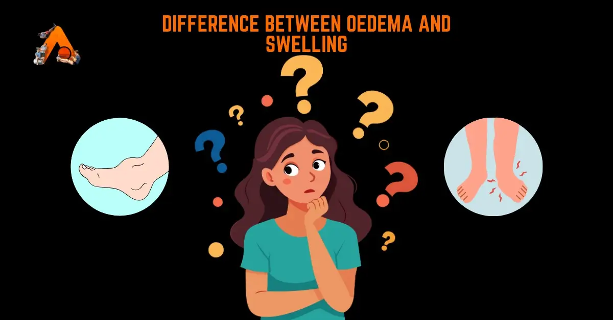 Difference Between Oedema and Swelling