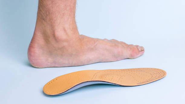 Flat foot treatment and cure