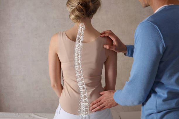 Kyphosis Spinal conditions